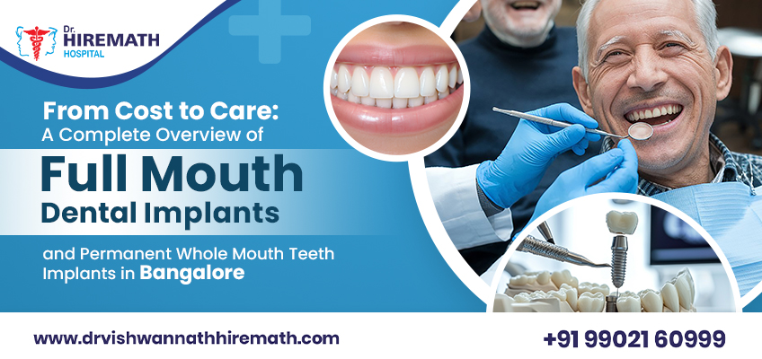 full-mouth-dental-implants-bangalore-permanent-teeth